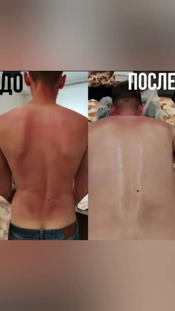 Массаж и реабилитация — портфолио